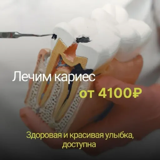 При лечении 4-х зубов, дарим профессиональную чистку - SIVOMI | Здоровье | Якутск